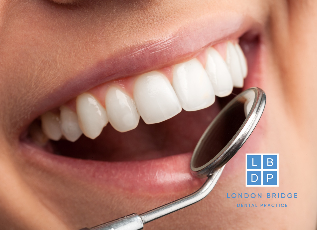 10% Off Treatments at London Bridge Dental Practice